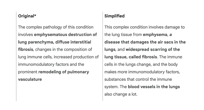 iOS 版 Google App 新增「簡化」功能，透過 AI 將複雜文本一鍵變簡單